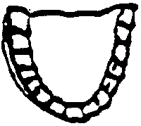 Sign -- Large Dentures